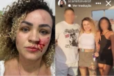 Blogueira denuncia agressão de ex-companheiro e amiga pelas redes sociais