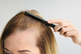 Alopecia feminina: causas, diagnóstico e os tratamentos mais eficazes