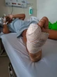 Crianças são mutiladas em brinquedo de condomínio no Litoral Norte da Bahia