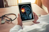 Queda nas mortes por meningite desacelera e ameaça metas da OMS para 2030