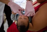 Prefeitura de Lauro de Freitas oferece cirurgia gratuita para corrigir 'língua presa' em bebês