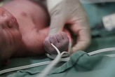 Brasil pede desculpas por mortes de 96 bebês em Cabo Frio
