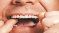 6 dicas de como manter os dentes saudáveis e evitar queda na terceira idade