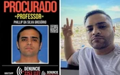 Chefe do CV monta estrutura para fazer lipoaspiração em casa e não precisar sair da comunidade