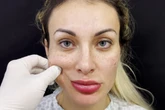 Andressa Urach exibe ‘novo rosto’ após cirurgia de R$ 240 mil; veja foto