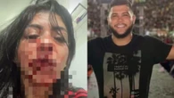 Cantor de forró se entrega à polícia após espancar companheira