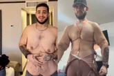 Influenciador que perdeu 150 kg faz cirurgia para retirar 7 kg de excesso de pele e impressiona; veja transformação