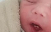 Bebê nasce com dois dentes e surpreende família: 'Fiquei perplexo'