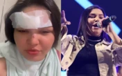 Cantora caída no chão é agredida com garrafa de vidro: 'Por causa de ciúme'