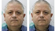 Quem é o ginecologista preso suspeito de filmar paciente com câmera escondida durante consulta em Salvador
