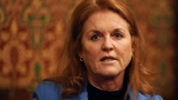 Así es el melanoma de Sarah Ferguson: más frecuente en mujeres pero más mortal en hombres