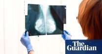 Drug that can halve breast cancer risk offered to 289,000 women in England