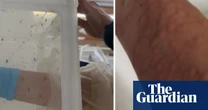 Mosquito colony feeds on blood from scientist's arm  – video