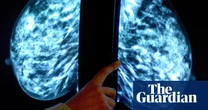 NHS could start offering breast cancer checks to women in their thirties