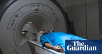 Millions in west do not know they have aggressive fatty liver disease, study says