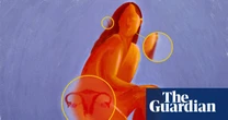 Can a name change transform PCOS outcomes for women? – podcast