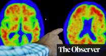 New Alzheimer’s drugs bring hope of slowing disease for UK patients