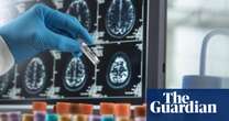 Doctored by Charles Piller review – the scandal that derailed Alzheimer’s research