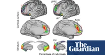 Part of brain network much bigger in people with depression, scientists find