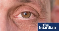 Blinking fools? The men who think shaving off their eyelashes will make them more masculine