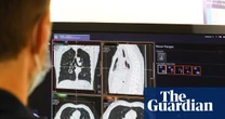 NHS spends record £241m outsourcing scan analysis to private firms
