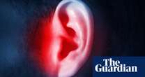 The debilitating impact of tinnitus, and how a new app could help – podcast