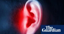 New app can reduce debilitating impact of tinnitus, say researchers