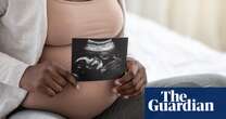 Science Weekly Why are black women four times more likely to die in childbirth? – podcast