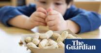 Giving young children peanut products cuts allergy risk, study finds