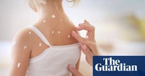 Sight of someone potentially infectious causes immune response, research suggests