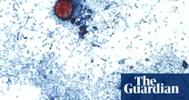 US outbreak of parasite causing ‘watery diarrhea’ rises to more than 2,800 cases