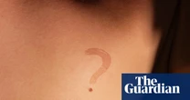 Sali Hughes on beauty: I make no apologies for repeating myself – keeping track of your moles is vital