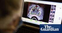 UK trails other countries on waiting times for cancer treatment, study finds