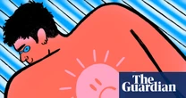 Burn notice: Gen Z and the terrifying rise of extreme tanning