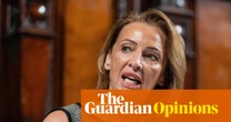 How the free speech debate stops us from stating the bleeding obvious | Zoe Williams