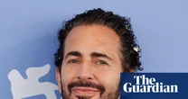 Social media and weight loss drugs drive UK rise in facelifts in men and people in their 40s