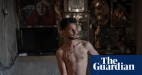 A man from Shiraz bares his scars: Shayan Sajadian’s best photograph