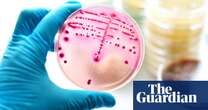 Australian women to get self tests for chlamydia and gonorrhoea – but experts urge caution