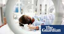 Our lifesaving device for small babies is stuck in development | Letter