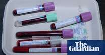 Medical research Blood test for 50 types of cancer could speed up patient diagnosis, study suggests