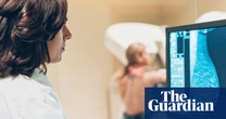 Women who miss first breast cancer screening at ‘40% higher risk’ of dying from the disease