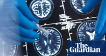 Optimists share similar brain patterns when thinking about the future, scans show