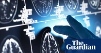 Effect of ‘gamechanger’ Alzheimer’s drugs ‘trivial’, review concludes