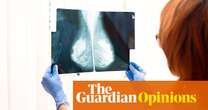 Medical research Why did my mammogram not detect my stage three breast cancer?