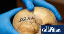 Edinburgh University’s ‘skull room’ highlights its complicated history with racist science