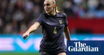 Georgia Stanway has knee operation in blow to Lionesses before Euro 2025