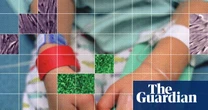 Autistic children injected with unapproved stem cell treatments supported by RFK Jr