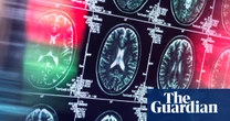 Antidepressants and antipsychotics could serve as alternatives to opioids, study finds