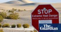 Man gets third-degree burns from walking on sand dunes in California