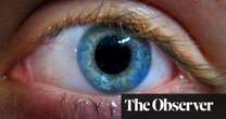 High street opticians could use AI to spot dementia risk with eye scan